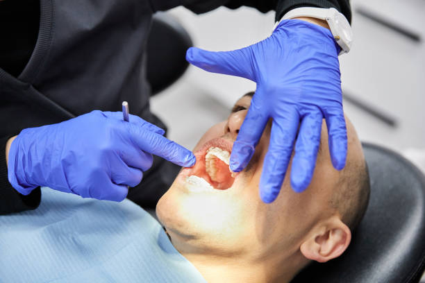 Best Broken or Chipped Tooth Repair in Fairview Park, IN